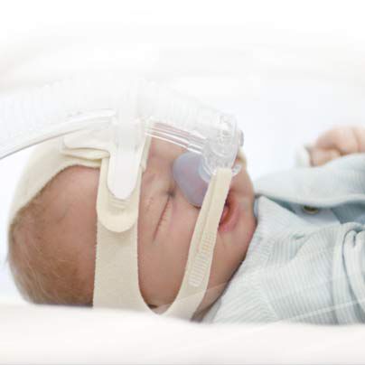 Nasal continuous positive airway pressure (NCPAP) for neonates